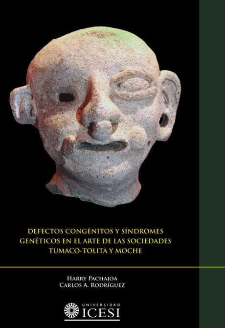 Imagen de Defectos congénitos y síndromes genéticos